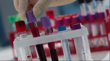 医学实验室的血液测试瓶放置特写